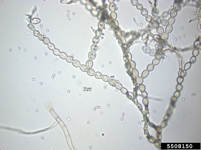 Гриб Monilinia fructicola под микроскопом. 