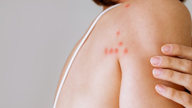 Как и некоторые кровососущие насекомые, они могут передавать возбудителей болезней от одного хозяина к другому. Как и некоторые кровососущие насекомые, они могут передавать возбудителей болезней от одного хозяина к другому.