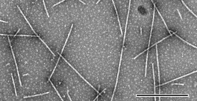 Вирус, если упрощённо, представляет собой ДНК или РНК в белковой, иногда ещё и жировой оболочке. Вирус, если упрощённо, представляет собой ДНК или РНК в белковой, иногда ещё и жировой оболочке.